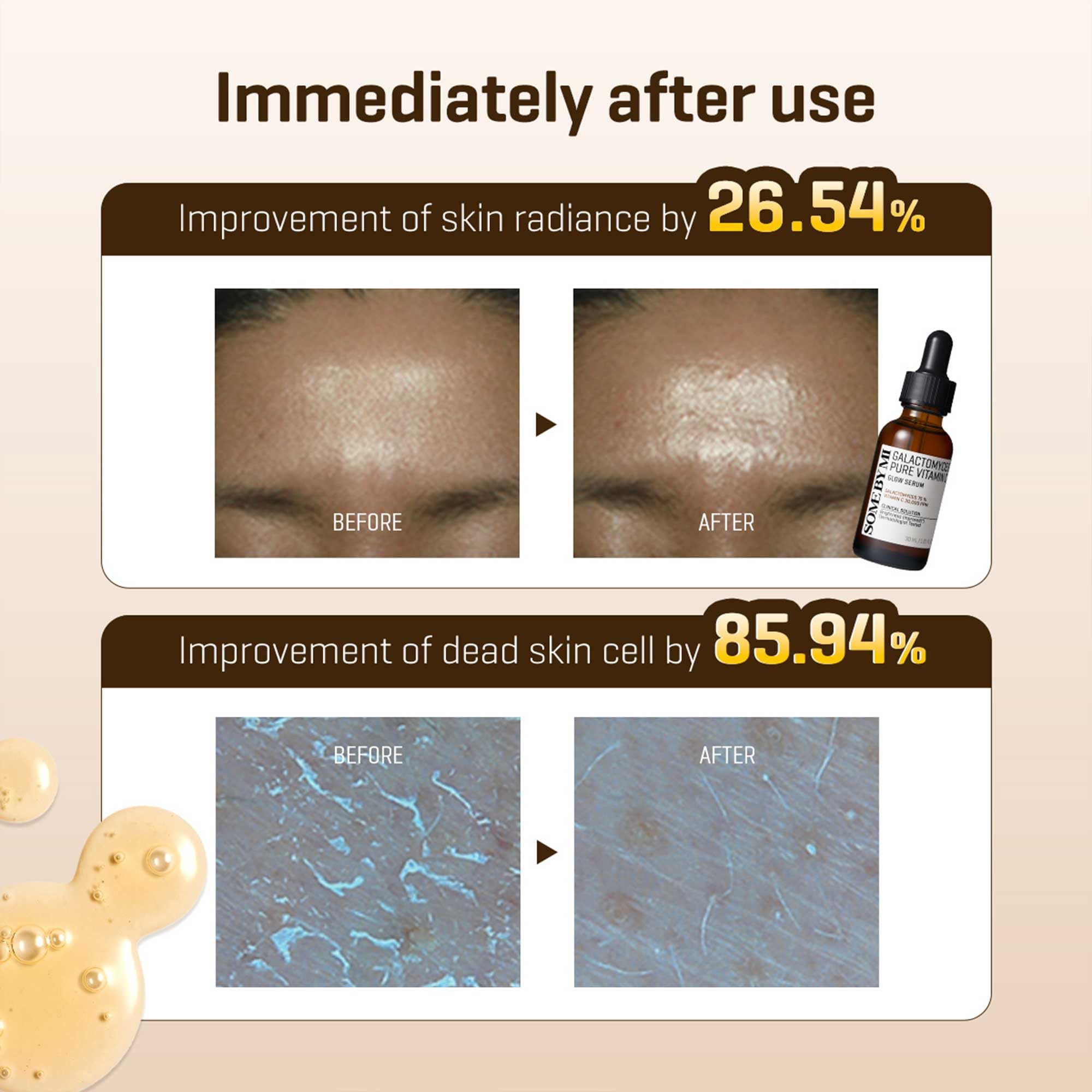 SOME BY MI Galactomyces Pure Vitamin C Glow Serum - 1.01Oz, 30ml - Korean Vitamin C Face Serum for Glow Glass Skin - Dark Spot Correcting Ampule with Brightening and Elasticity Care - Korean Skin Care - Image 7