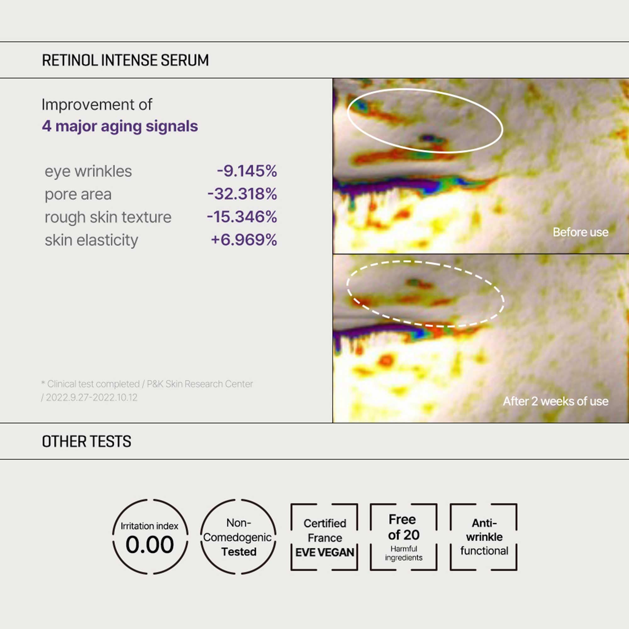 SOME BY MI Retinol Intense Trial Kit - Serum and Eye Cream, 0.33Oz - Mild Korean 0.1% Retinol Face Serum and Eye Cream for Beginner - Skin Texture, Elasticity and Under Eye Care - Korean Skin Care - Image 5