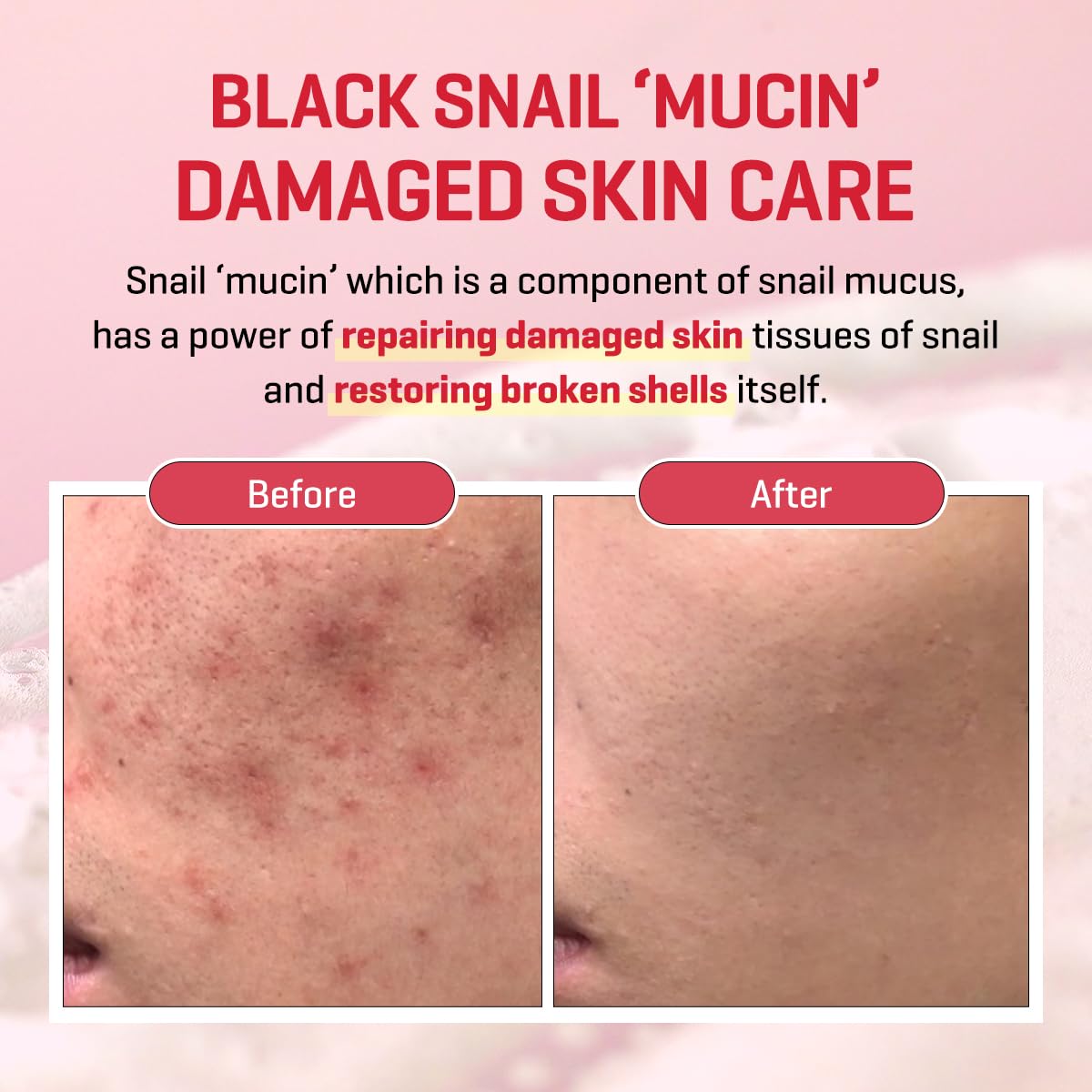 SOME BY MI Snail Trucica Miracle Repair Serum - 1.69Oz, 50ml - Made from Snail Mucin for Sensitive Skin - Daily Repair Face Serum for Post Acne Marks and Strengthen Skin Barrier - Korean Skin Care - Image 4