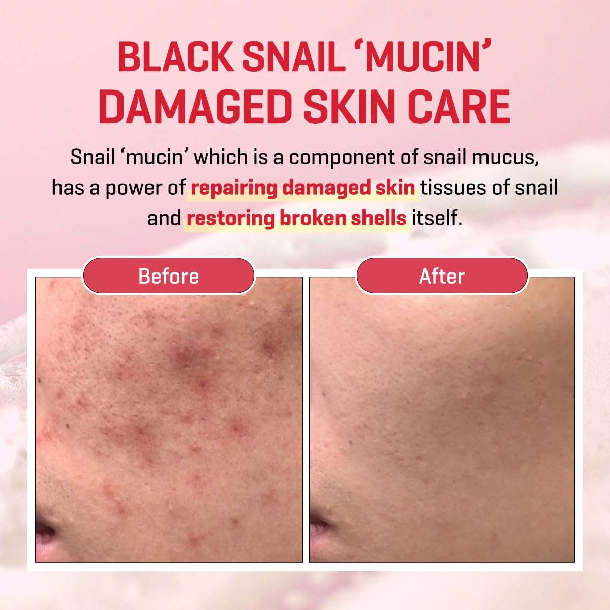 SOME BY MI Snail Truecica Miracle Repair Low pH Gel Cleanser - 3.38Oz, 100ml - Made from Snail Mucin for Sensitive Skin - Daily Face Wash for Deep Cleansing and Skin Moisturizing - Korean Skin Care - Image 4