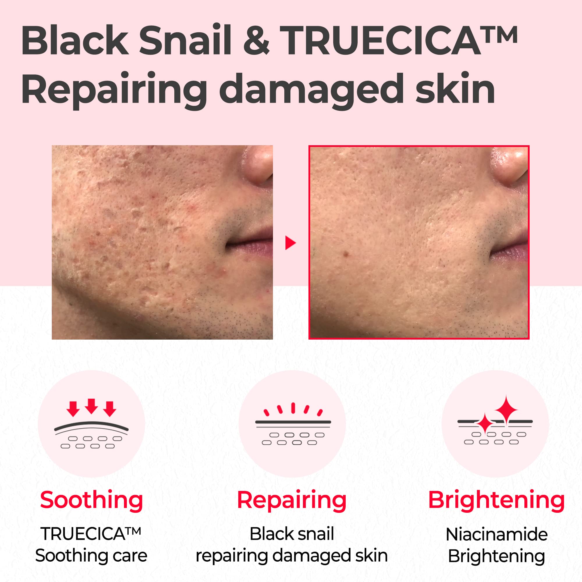 SOME BY MI Snail Truecica Miracle Repair Toner - 4.6Oz, 135ml - Made from Snail Mucin for Sensitive Skin - Daily Repair Face Toner with Skin Texture and Pigmentation Care - Korean Skin Care - Image 3